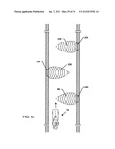 Protection of a Medical Device Against RFID-Associated Electromagnetic     Interference Like an Automobile Keyless Entry System Having an RFID     Interrogator diagram and image