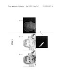 METHOD AND APPARATUS FOR RECOGNIZING A PROTRUSION ON A FACE diagram and image