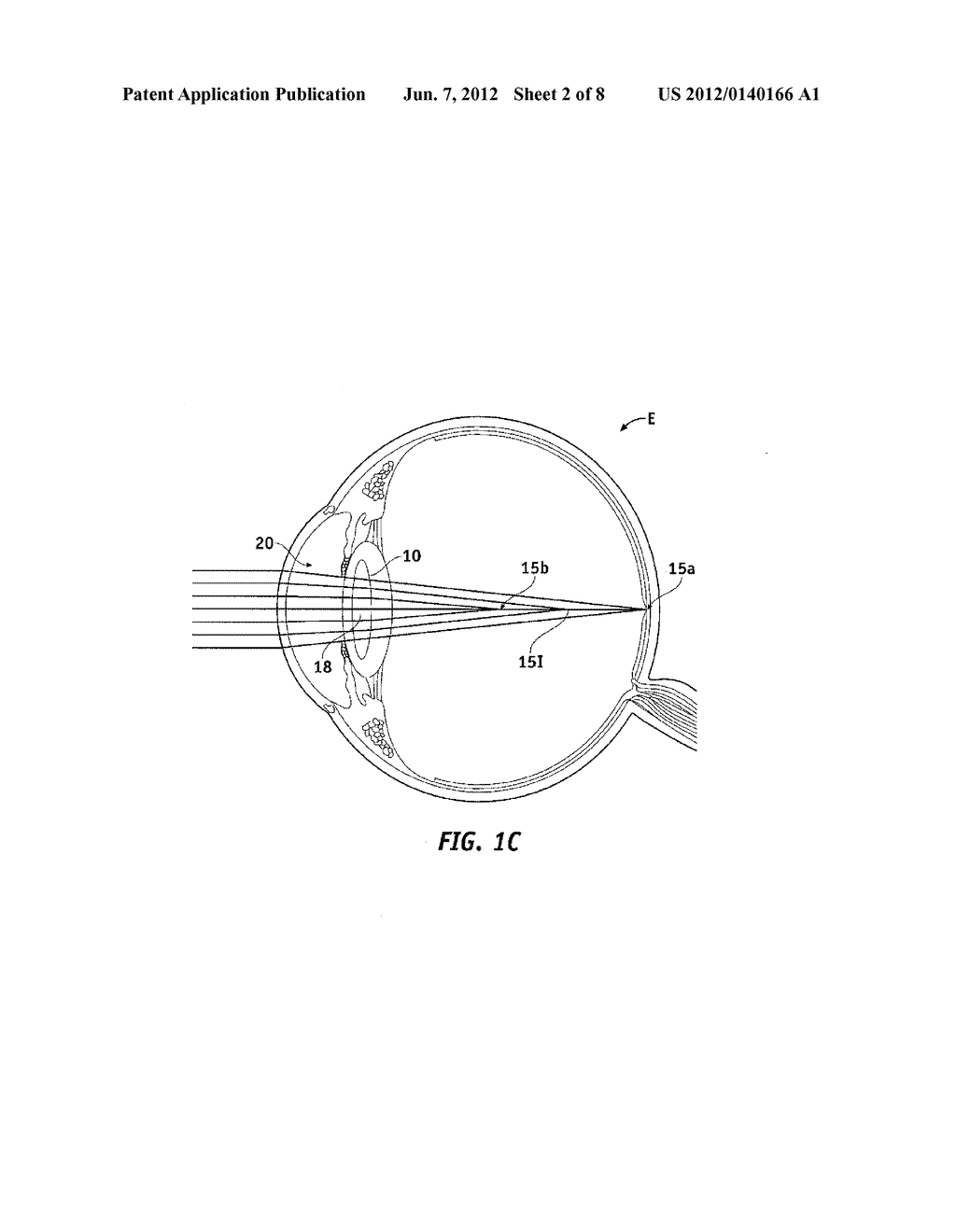 PUPIL DEPENDENT DIFFRACTIVE LENS FOR NEAR, INTERMEDIATE, AND FAR VISION - diagram, schematic, and image 03