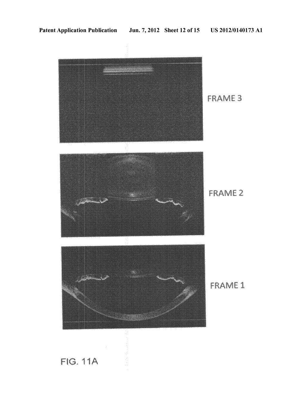 Intraoperative Imaging System and Apparatus - diagram, schematic, and image 13