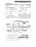 SPECTRAL DOMAIN OPTICAL COHERENCE TOMOGRAPHY SYSTEM diagram and image