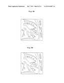 BODY SECTION RADIOGRAPHIC APPARATUS, AND A NOISE REMOVING METHOD FOR THE     BODY SECTION RADIOGRAPHIC APPARATUS diagram and image