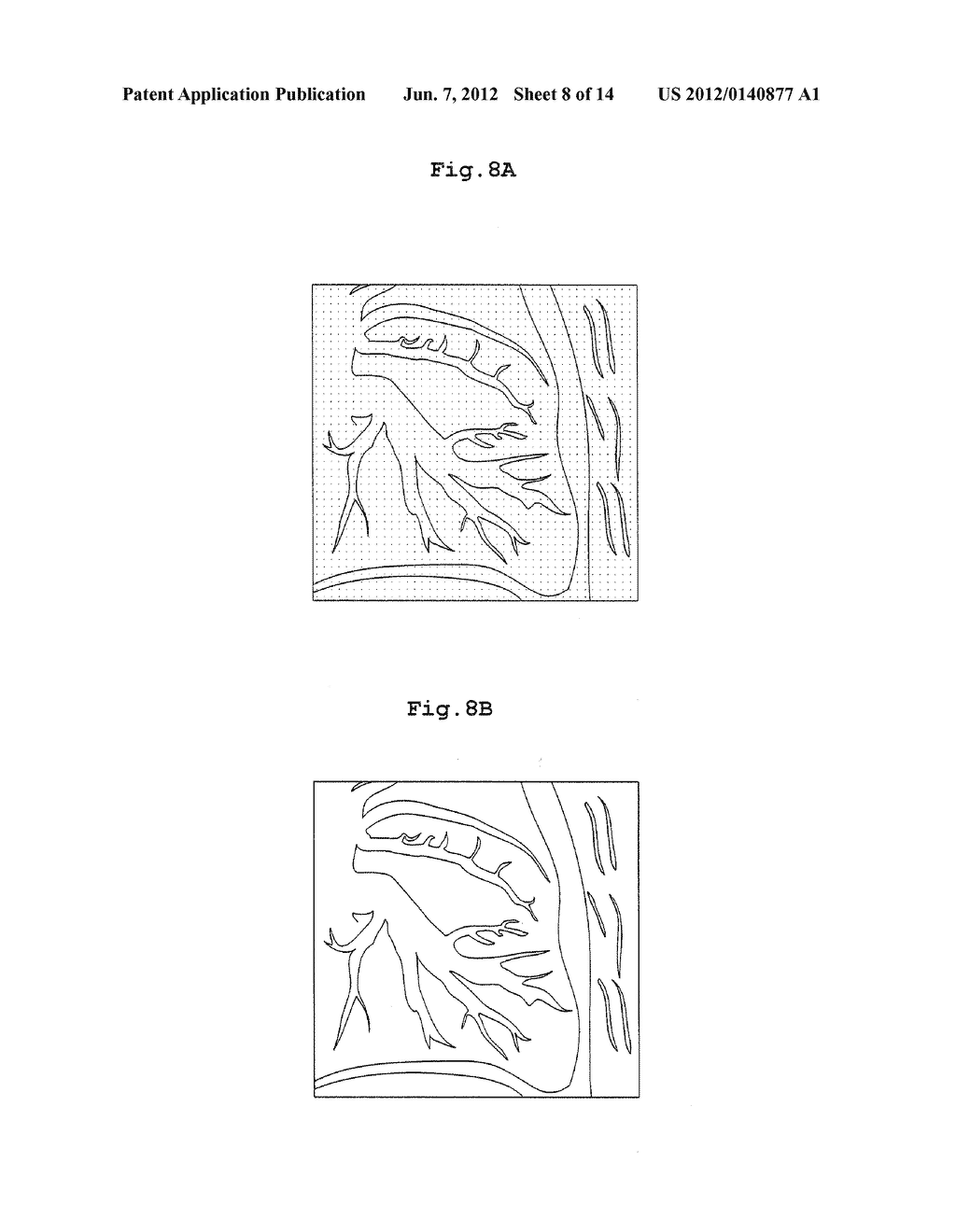 BODY SECTION RADIOGRAPHIC APPARATUS, AND A NOISE REMOVING METHOD FOR THE     BODY SECTION RADIOGRAPHIC APPARATUS - diagram, schematic, and image 09