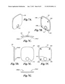 Headset with Noise Plates diagram and image