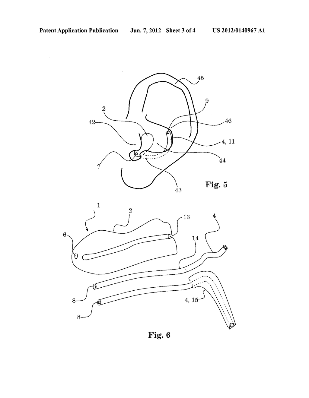 HEARING DEVICE WITH A VENT EXTENSION AND METHOD FOR MANUFACTURING SUCH A     HEARING DEVICE - diagram, schematic, and image 04