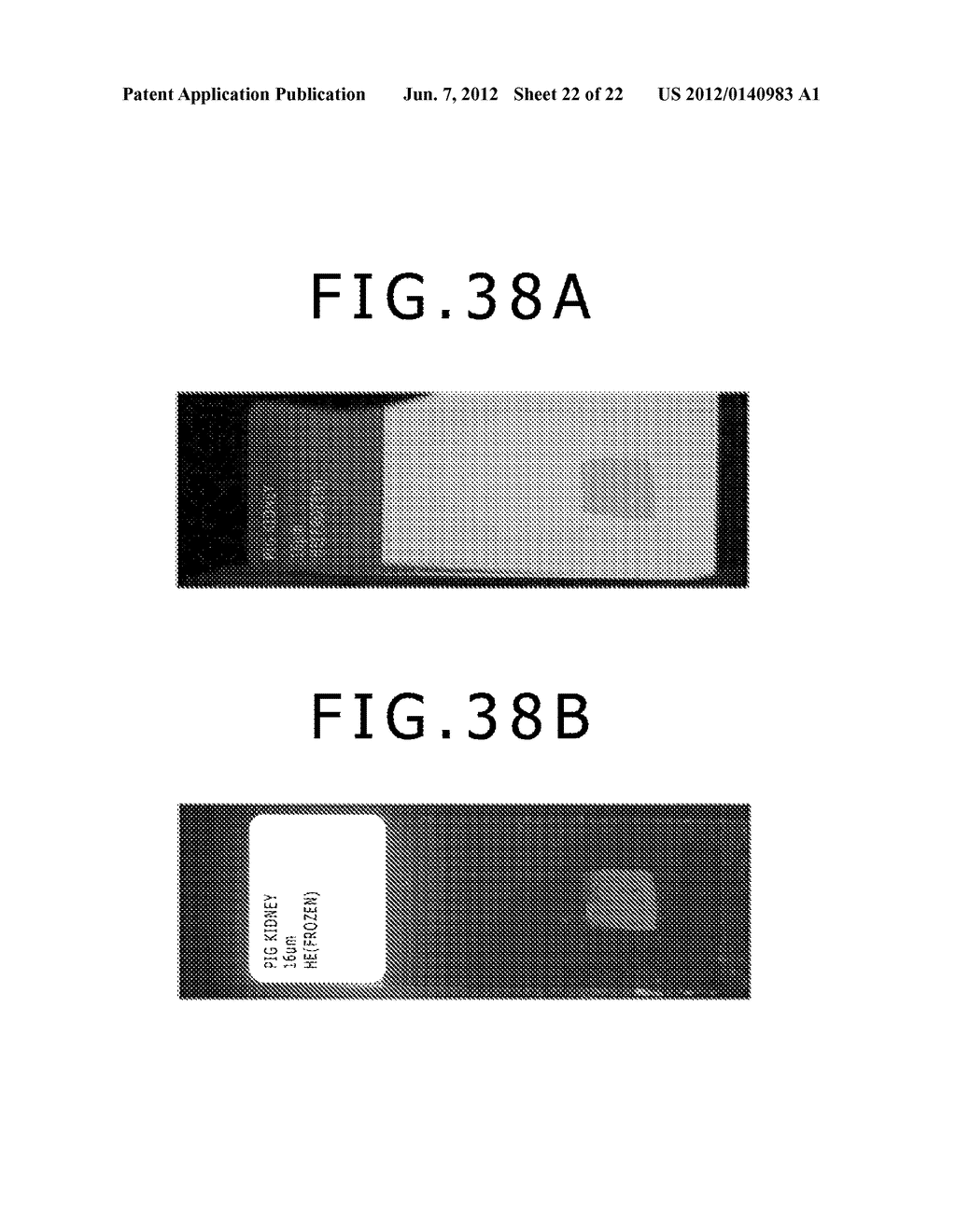 METHOD FOR DETECTION OF SPECIMEN REGION, APPARATUS FOR DETECTION OF     SPECIMEN REGION, AND PROGRAM FOR DETECTION OF SPECIMEN REGION - diagram, schematic, and image 23