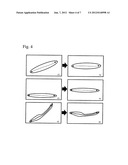 Deformable Motion Correction for Stent Visibility Enhancement diagram and image