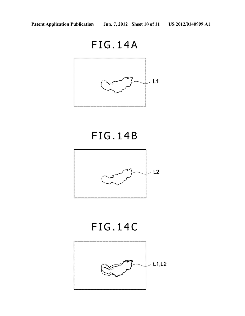 IMAGE PROCESSING METHOD, IMAGE PROCESSING APPARATUS, AND IMAGE PROCESSING     PROGRAM - diagram, schematic, and image 11