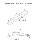 WIND TURBINE BLADE EDGE MONITORING SYSTEM diagram and image