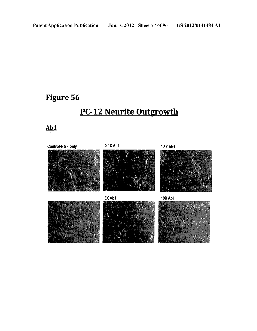 METHODS OF PREVENTING INFLAMMATION AND TREATING PAIN USING ANTI-NGF     COMPOSITIONS - diagram, schematic, and image 78