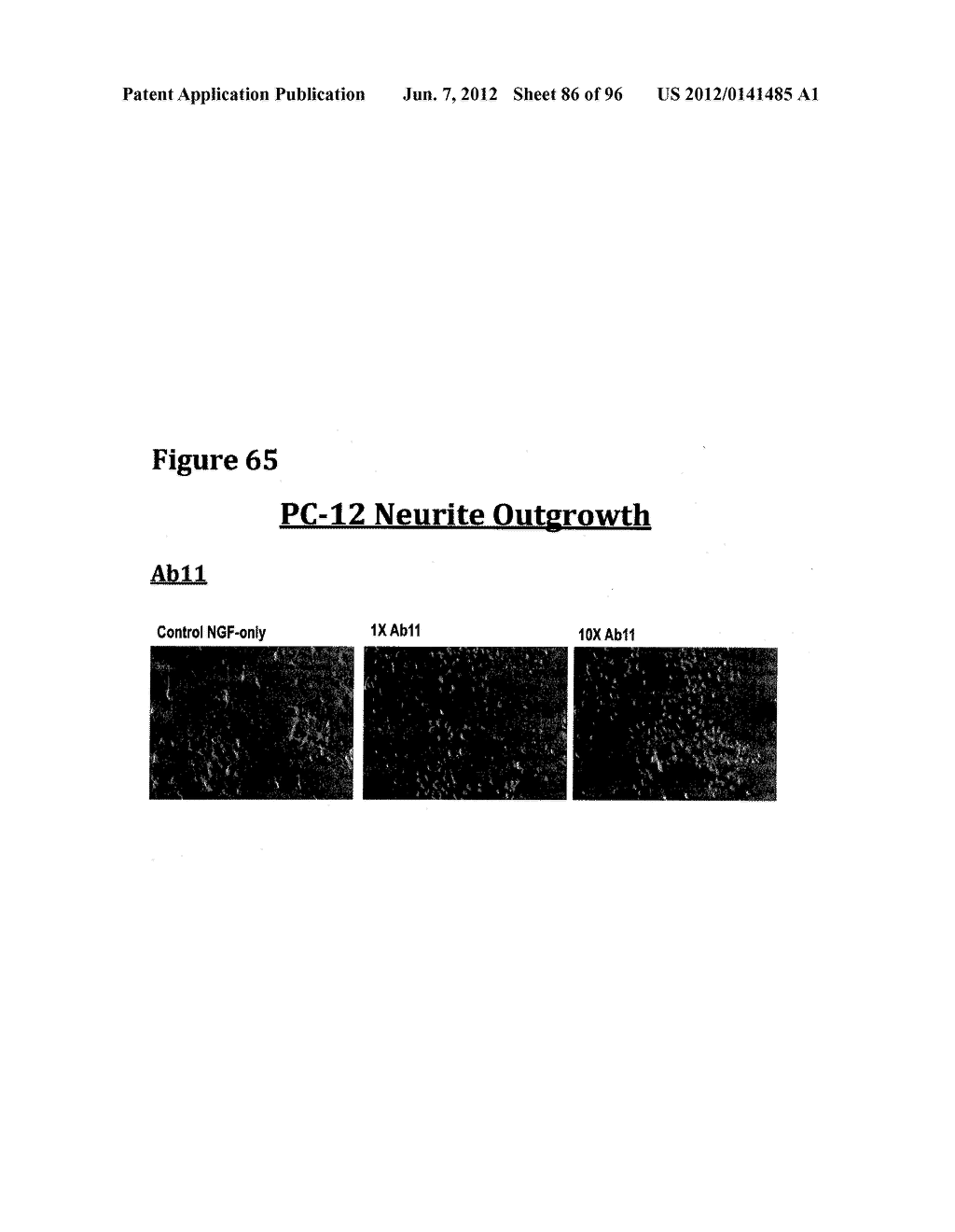 METHODS OF PREVENTING OR TREATING PAIN USING ANTI-NGF ANTIBODIES - diagram, schematic, and image 87