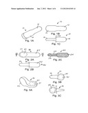 Solid Dosage Form That Promotes Reliable Oral, Esophageal and GI Transit diagram and image