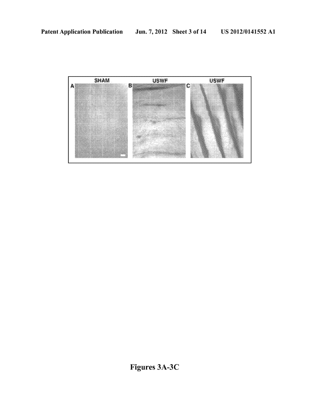 ULTRASOUND TECHNOLOGY TO CONTROL THE SPATIAL ORGANIZATION OF CELLS AND     PROTEINS IN ENGINEERED TISSUES - diagram, schematic, and image 04