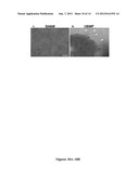 ULTRASOUND TECHNOLOGY TO CONTROL THE SPATIAL ORGANIZATION OF CELLS AND     PROTEINS IN ENGINEERED TISSUES diagram and image