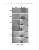 ULTRASOUND TECHNOLOGY TO CONTROL THE SPATIAL ORGANIZATION OF CELLS AND     PROTEINS IN ENGINEERED TISSUES diagram and image