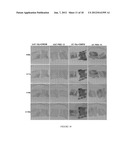 UMBILICAL CORD AMNIOTIC MEMBRANE PRODUCTS diagram and image