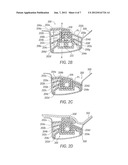 REINFORCER WITH PRE-APPLIED BONDING MATERIAL diagram and image