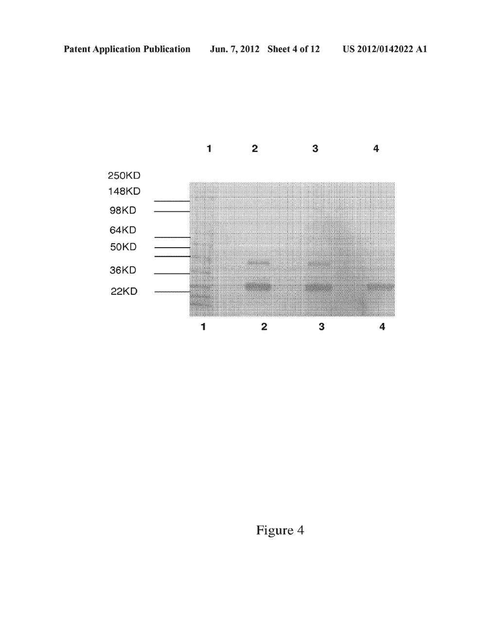 GLYCOSYLATED MAMMALIAN NGAL AND USE THEREOF - diagram, schematic, and image 05