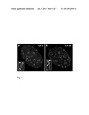 Recombinant Gene Expression diagram and image