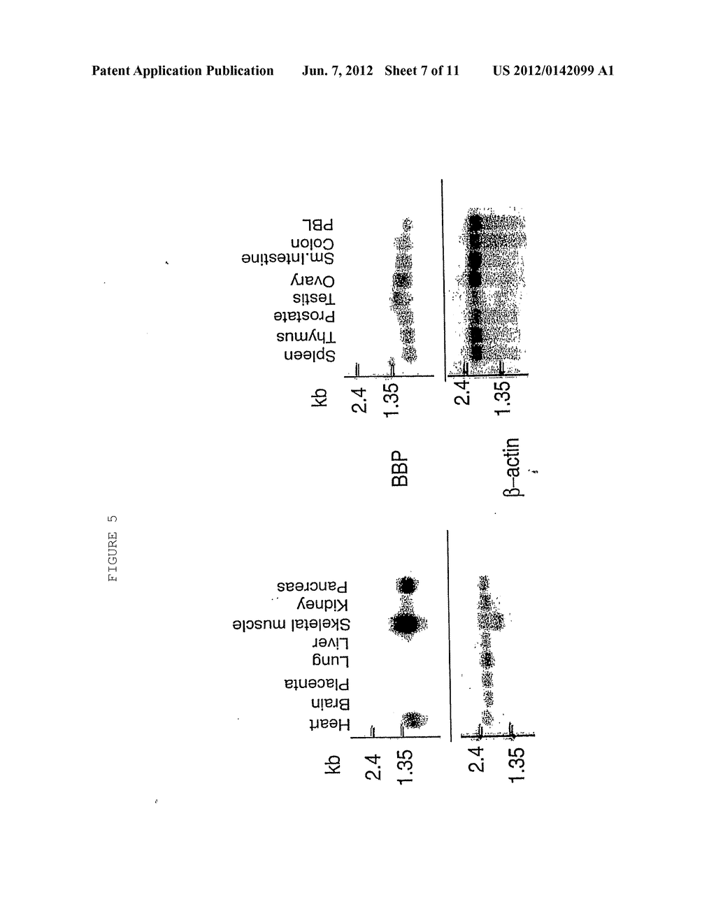 NOVEL BAK BINDING PROTEIN, DNA ENCODING THE PROTEIN, AND METHODS OF USE     THEREOF - diagram, schematic, and image 08