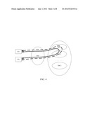 METHOD AND SYSTEM FOR IMPLEMENTING LOCAL CALL LOCAL SWITCH diagram and image