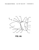 Golf Club Heads or Other Ball Striking Devices Having Distributed Impact     Response diagram and image