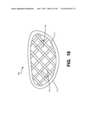 Golf Club Heads or Other Ball Striking Devices Having Distributed Impact     Response diagram and image