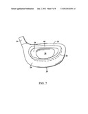 GOLF CLUB HEAD HAVING A COMPOSITE CROWN diagram and image