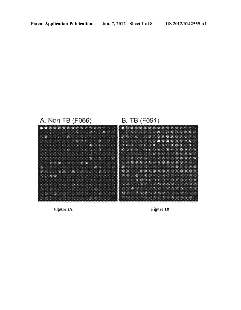 Compositions And Methods For Immunodominant Antigens of Mycobacterium     Tuberculosis - diagram, schematic, and image 02