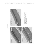 Methods for Treating Diseases of the Retina diagram and image