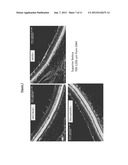 Methods for Treating Diseases of the Retina diagram and image