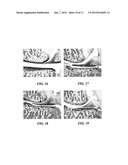 ANTIFOLATE COMBINATIONS diagram and image