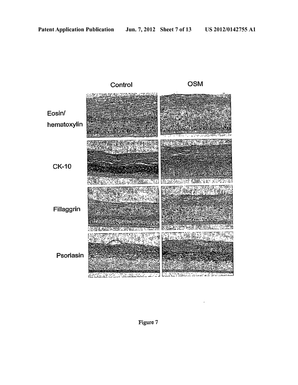 COMPOSITIONS FOR PREVENTING, REDUCING OR TREATING KERATINOCYTE-MEDIATED     INFLAMMATION - diagram, schematic, and image 08