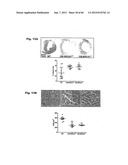 Method for Preventing and Treating Cardiovascular Diseases with BRCA1 diagram and image