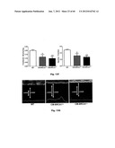 Method for Preventing and Treating Cardiovascular Diseases with BRCA1 diagram and image