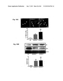 Method for Preventing and Treating Cardiovascular Diseases with BRCA1 diagram and image