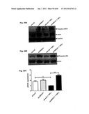 Method for Preventing and Treating Cardiovascular Diseases with BRCA1 diagram and image