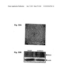 Method for Preventing and Treating Cardiovascular Diseases with BRCA1 diagram and image