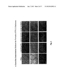 Prevention and Treatment of Synucleinopathic and Amyloidogenic Disease diagram and image