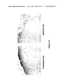 Prevention and Treatment of Synucleinopathic and Amyloidogenic Disease diagram and image