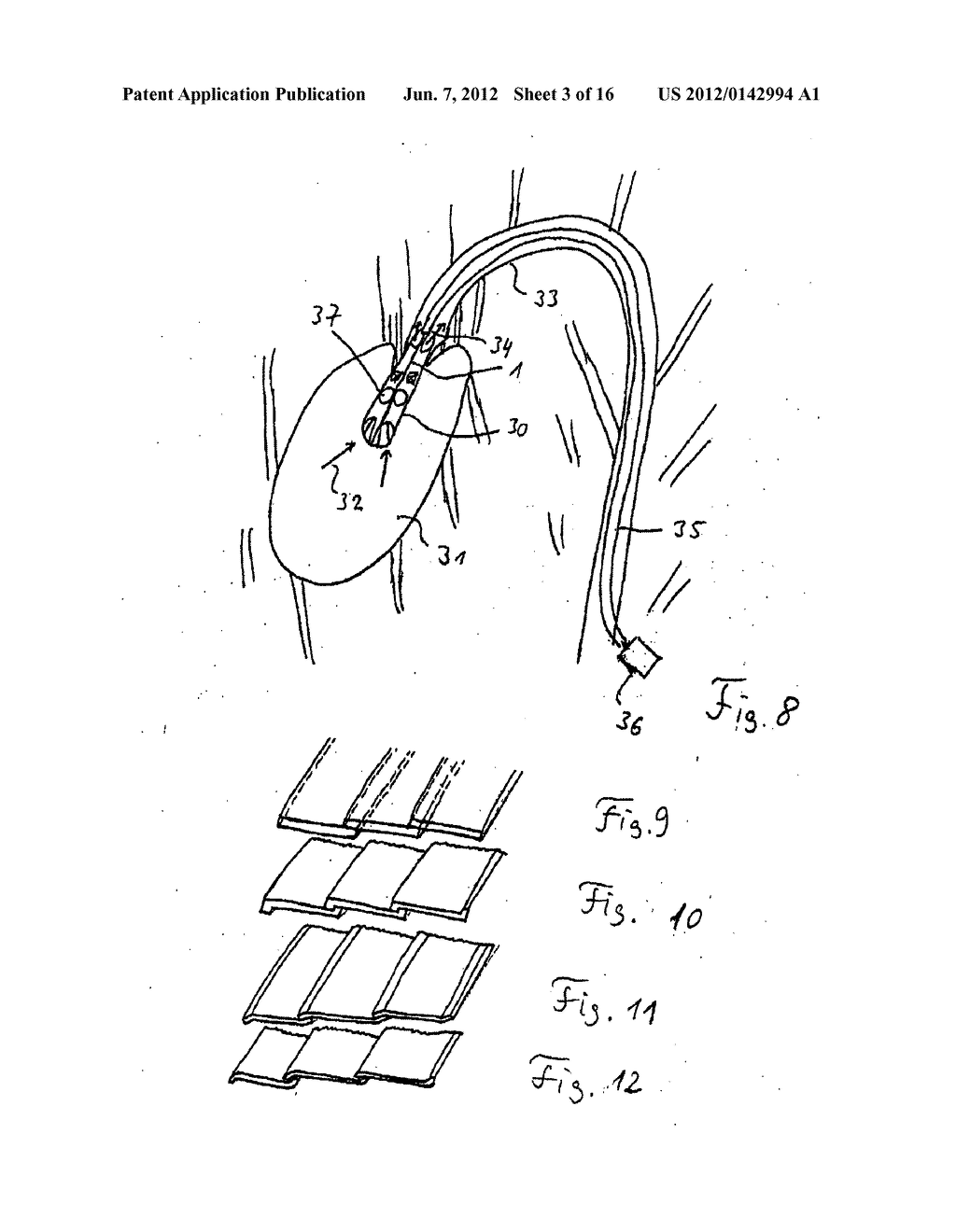 COMPRESSIBLE AND EXPANDABLE BLADE FOR A FLUID PUMP - diagram, schematic, and image 04