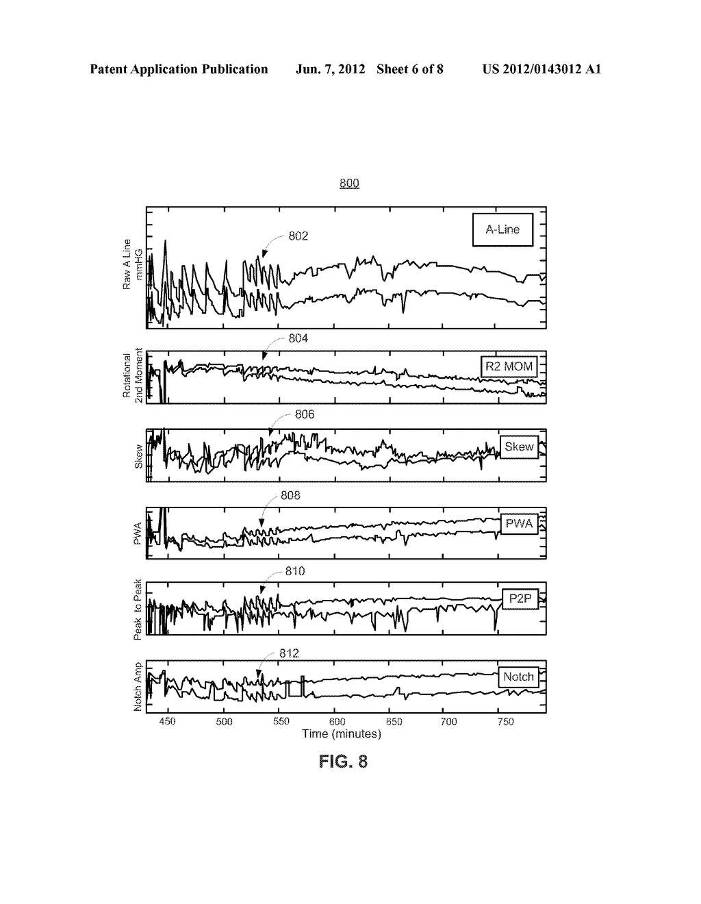 SYSTEMS AND METHODS FOR PHYSIOLOGICAL EVENT MARKING - diagram, schematic, and image 07