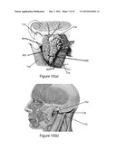 SYSTEM AND METHOD FOR FACIAL NERVE MONITORING DURING FACIAL SURGERY diagram and image