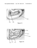 SYSTEM AND METHOD FOR FACIAL NERVE MONITORING DURING FACIAL SURGERY diagram and image