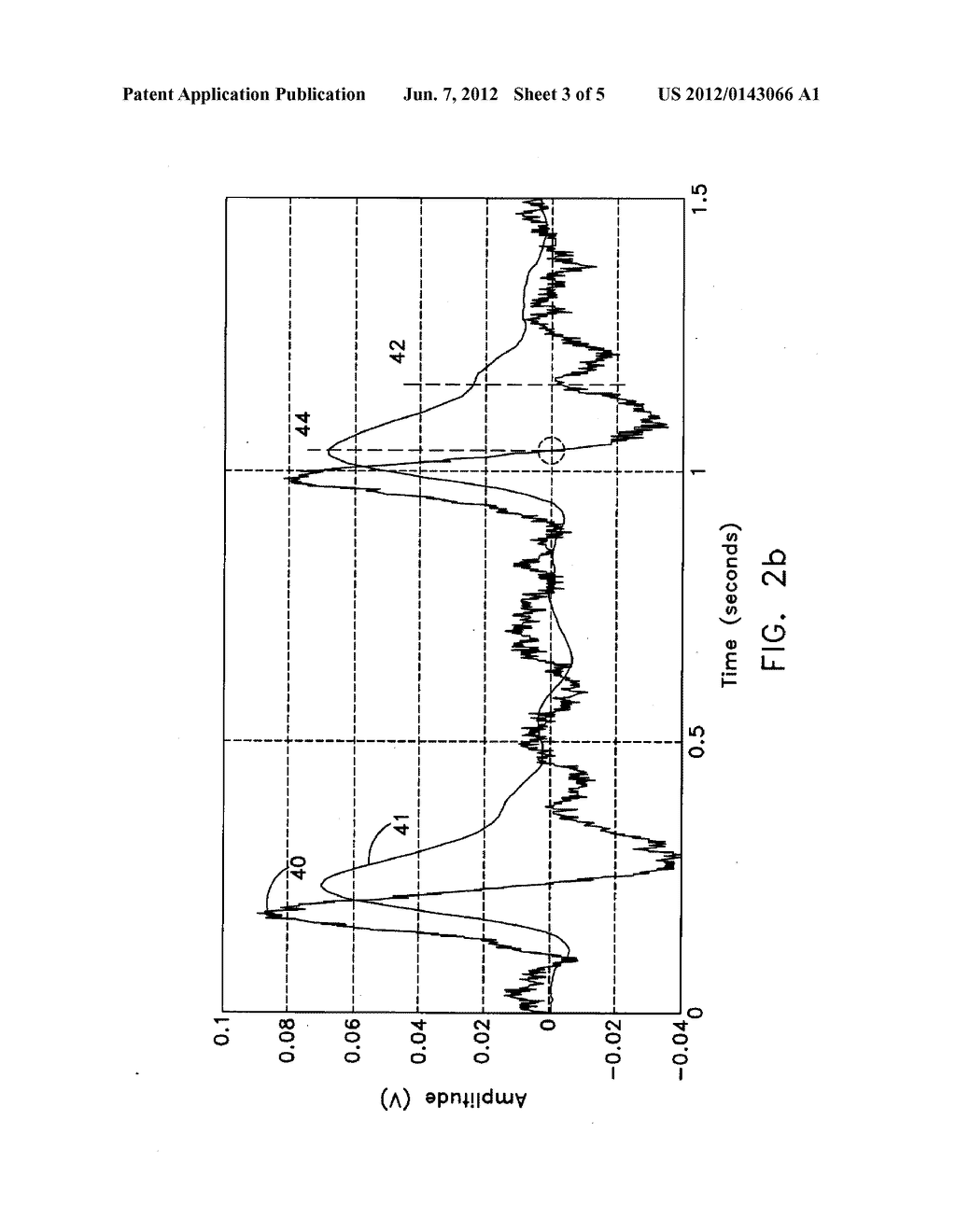 Remote Blood Pressure Waveform Sensing Method - diagram, schematic, and image 04