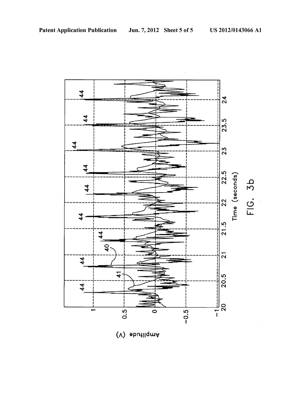 Remote Blood Pressure Waveform Sensing Method - diagram, schematic, and image 06