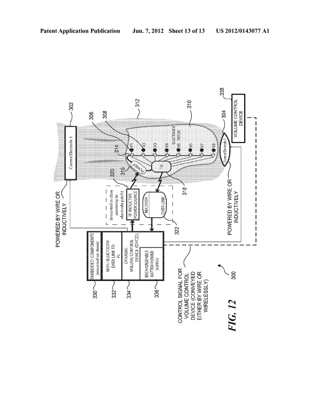 MEASUREMENT AND USE OF IN-SOCKET RESIDUAL LIMB VOLUME CHANGE DATA FOR     PROSTHETIC FITTING - diagram, schematic, and image 14