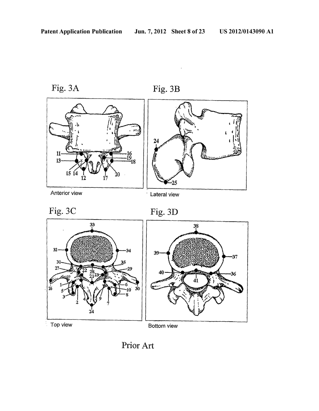 Assessment of Spinal Anatomy - diagram, schematic, and image 09