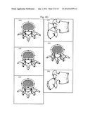 Assessment of Spinal Anatomy diagram and image