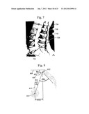 Assessment of Spinal Anatomy diagram and image